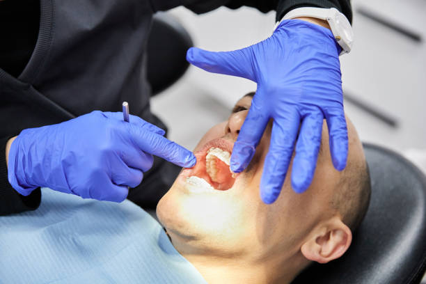 Best Emergency Dentist for Knocked-Out Tooth in Esperance, WA